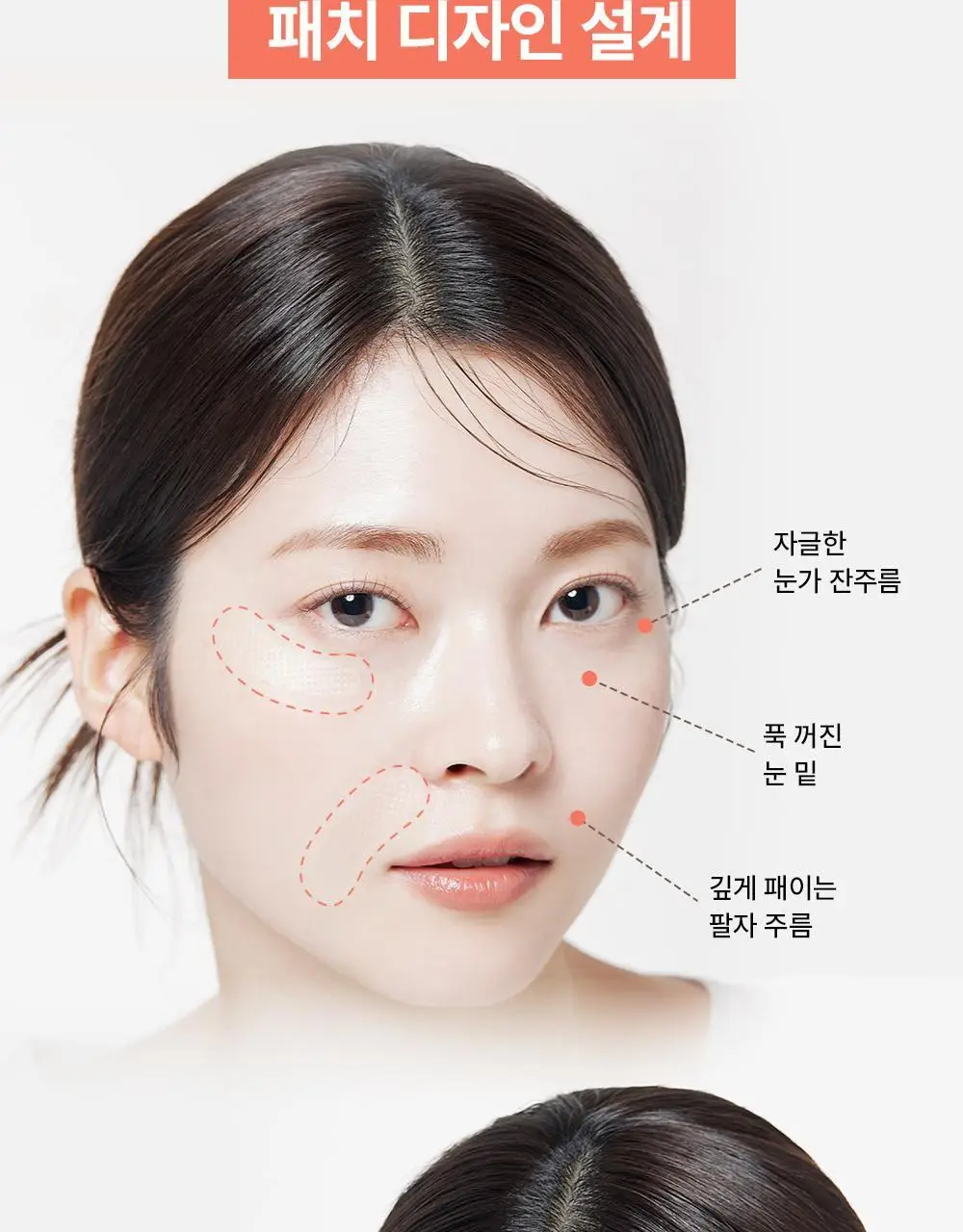 [주름패치]아크로패스 레티알엔 마이크로콘 패치 (미간/눈가팔자 중 택1) 상세페이지 26